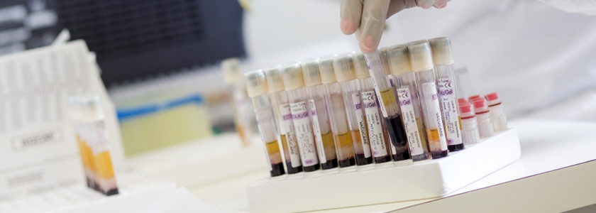 We Re Doing Well But The Battle Goes On De Beers Group